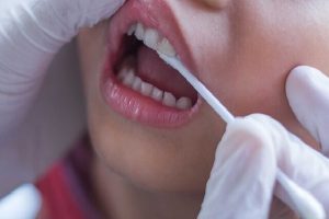 یک عامل افزایش خطر ابتلا به سرطان لوزالمعده